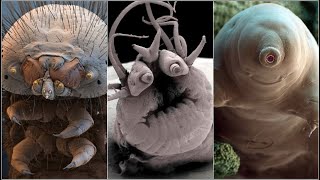 Incredible Electron Microscope Images [upl. by Grimonia]