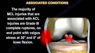 Medial Collateral Ligament injury  MCL Injuries  Everything You Need To Know  Dr Nabil Ebraheim [upl. by Nivan]