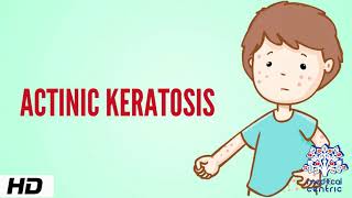 Actinic keratosis Causes Signs and Symptoms Diagnosis and Treatment [upl. by Ybocaj]