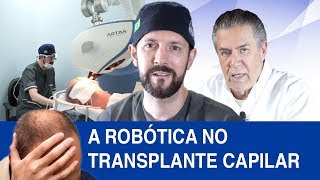 A Robótica no Transplante Capilar [upl. by Yrdnal]