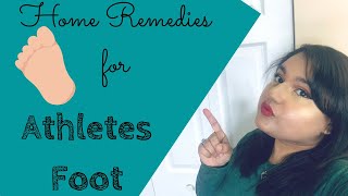 Home Remedies for Athletes Foot Treatment [upl. by Annayoj]