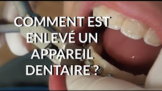 Comment est enlevé un appareil dentaire  Appareildentaireinfo [upl. by Macomber]