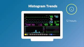 Invasive Monitoring Series Episode 1 CVP and Preload [upl. by Dnomyaw]