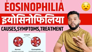 Eosinophilia Causes Symptoms amp Treatment In Hindi [upl. by Anihta168]