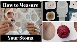 How to Measure Your Stoma OSTOMY TIPS [upl. by Aehc]