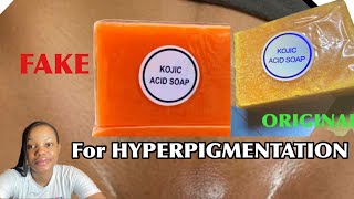 The Kojic Acid Soap That Works HOW TO IDENTIFY THE ORIGINAL [upl. by Roma]