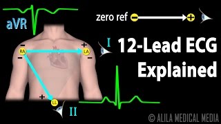 12 Lead ECG Explained Animation [upl. by Yorled]