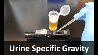 Urine Specific Gravity Refractometer [upl. by Lenahs]