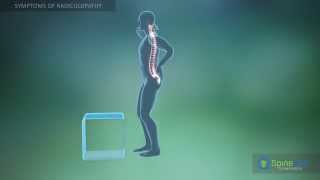 Radiculopathy Symptoms [upl. by Aicilaanna153]