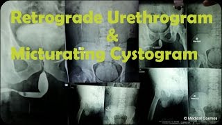 Diagnostic Imaging Explained XRay  CT Scan  Ultrasound  MRI [upl. by Ramirol662]