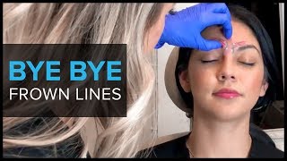 Why We Use BOTOX For Frown Lines [upl. by Magner]