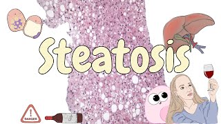 Steatosis  liver pathology [upl. by Wolfgang139]