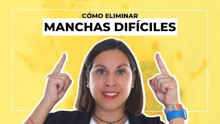 😱 Cómo QUITAR manchas DIFÍCILES de la ropa  7️⃣ REMEDIOS SENCILLOS 🧼 [upl. by Andras618]