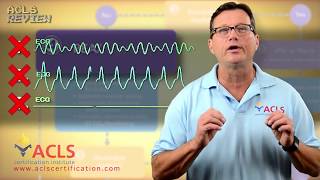 ACLS Adult Cardiac Arrest Algorithm  PEAAsystole [upl. by Raffaj3]