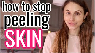 How to STOP PEELING SKIN Dr Dray [upl. by Anrahs]