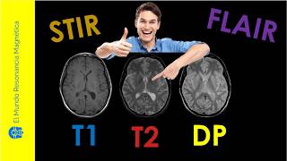 Vídeo 11 Potenciación de Secuencias de Resonancia Magnética Parámetros T1 T2 DP T2 Flair STIR [upl. by Eustasius]