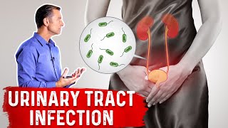 Top Natural Remedies for a UTI Urinary Tract Infection [upl. by Kati]