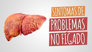 Sintomas de problemas no fígado [upl. by Dag]