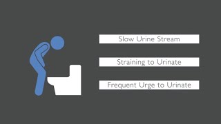 What Happens if you Leave a UTI Untreated [upl. by Ilellan596]