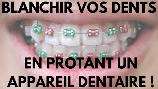 Comment Blanchir Vos Dents en Portant Un Appareil Dentaire [upl. by Adnoval]