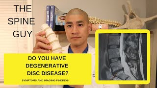 Lumbar Degenerative Disc Disease Part 1 Symptoms and Imaging [upl. by Ulla869]