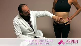 Liposuction Contour Irregularity  Stubborn Lipo Lumps and Bumps [upl. by Leorsiy663]