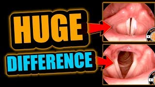 Singing amp Rapping Basics How Do Vocal Cords Work [upl. by Calica492]