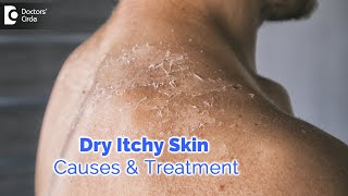 Top 3 Natural Remedies For Firm Tight Skin [upl. by Ratcliff]