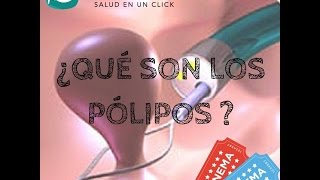 ¿Qué son los Pólipos [upl. by Nabatse]