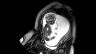 Foetal Development Unborn Baby Movement at 24 Weeks  WIRED [upl. by Toomay367]