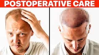 Hair Transplant PostOp Recovery [upl. by Butte]