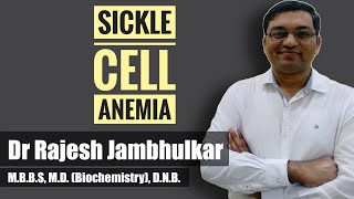 Sickle cell anemia [upl. by Blasius]