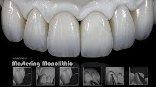 Mastering Monolithic Zirconia IN ENGLISH [upl. by Spiegelman]