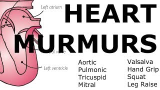 Heart Murmurs  Locations Maneuvers Buzzwords [upl. by Kele]