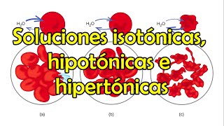 Soluciones isotónicas hipotónicas e hipertónicas [upl. by Irahcaz]