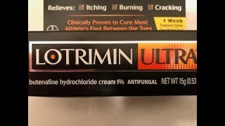 Treating Athletes Foot  Cream powder or spray [upl. by Eehtomit]