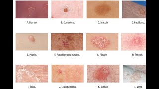 Skin Lesions with defination [upl. by Chellman]