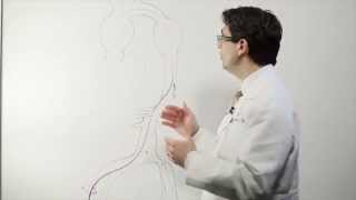 WEB® Aneurysm Embolization Animation [upl. by Langan936]