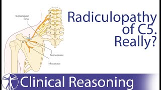 Lumbar Radiculopathies  Presentation Diagnosis amp Special Tests [upl. by Jaynes]