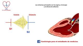 Auscultación de la estenosis valvular aórtica [upl. by Geraint]