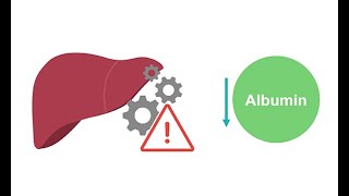 Getting to know albumin physiology [upl. by Ateiluj]