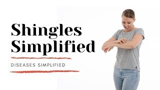 Shingles Simplified [upl. by Casey621]