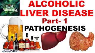 ALCOHOLIC LIVER DISEASE Part 1 Pathogenesis [upl. by Priebe]