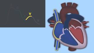 Interpreting Central Venous Pressure Waveforms by J DiNardo  OPENPediatrics [upl. by Sanchez]