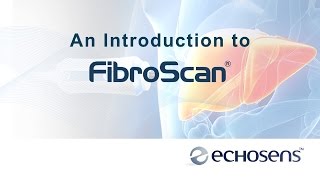 A Patients Introduction to FibroScan [upl. by Jacquenetta]