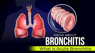 Bronchiectasis for USMLE [upl. by Noiztneb573]