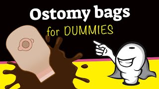 Ostomy bags for dummies [upl. by Parris647]