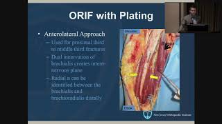 Humeral Shaft Fractures  John Callaghan MD [upl. by Deery]