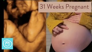 31 Weeks Pregnant What You Need To Know  Channel Mum [upl. by Omrellig4]