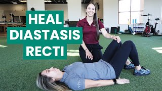 Exercises to Fix Your Diastasis Recti  Physical Therapy [upl. by Altaf]